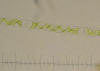 Picture of Spirogyra alga